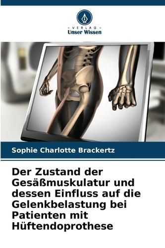 Der Zustand der Gesäßmuskulatur und dessen Einfluss auf die Gelenkbelastung bei Patienten mit Hüftendoprothese