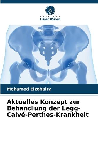 Aktuelles Konzept zur Behandlung der Legg-Calvé-Perthes-Krankheit