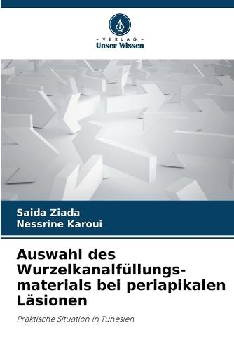 Auswahl des Wurzelkanalfüllungs-materials bei periapikalen Läsionen