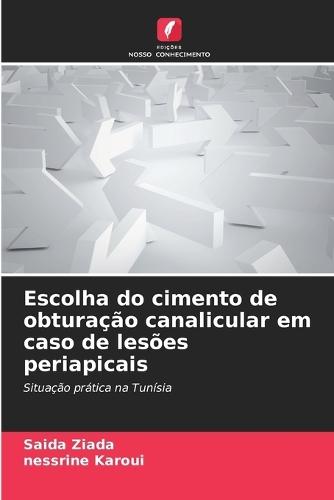 Escolha do cimento de obturação canalicular em caso de lesões periapicais