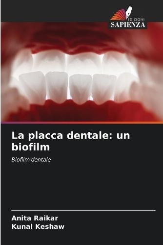 La placca dentale: un biofilm