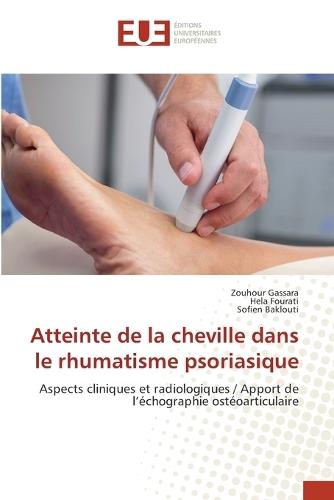 Atteinte de la cheville dans le rhumatisme psoriasique