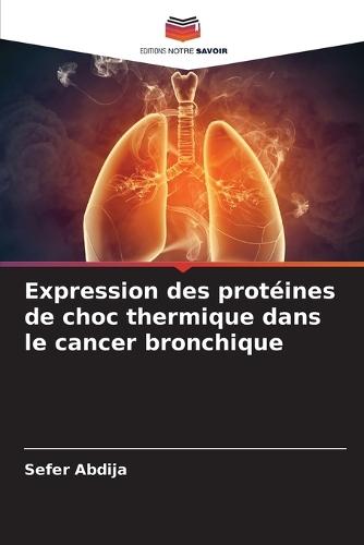Expression des protéines de choc thermique dans le cancer bronchique