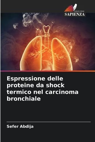Espressione delle proteine da shock termico nel carcinoma bronchiale