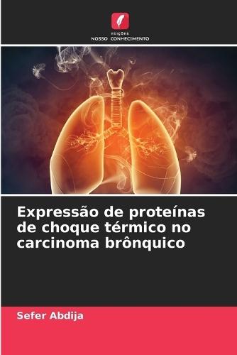 Expressão de proteínas de choque térmico no carcinoma brônquico