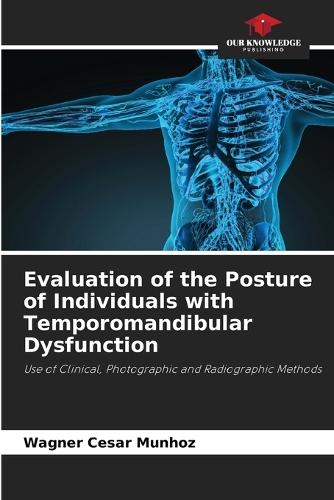 Evaluation of the Posture of Individuals with Temporomandibular Dysfunction
