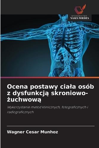 Ocena postawy ciala osób z dysfunkcją skroniowo-żuchwową