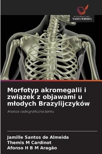 Morfotyp akromegalii i związek z objawami u mlodych Brazylijczyków