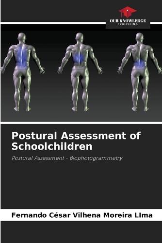 Postural Assessment of Schoolchildren
