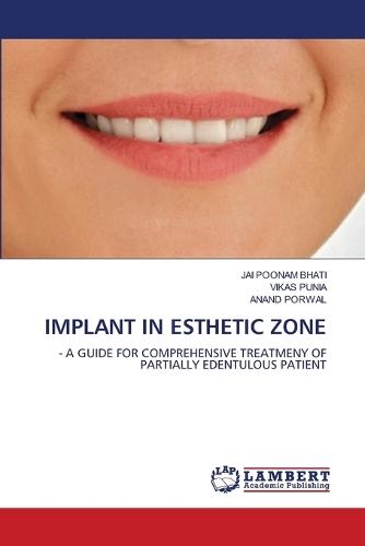 Implant in Esthetic Zone