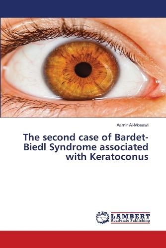 The second case of Bardet-Biedl Syndrome associated with Keratoconus