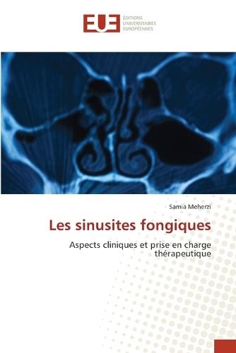 Les sinusites fongiques