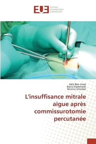 L'insuffisance mitrale aigue après commissurotomie percutanée