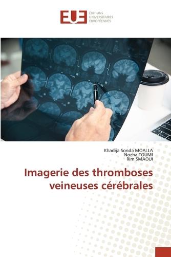 Imagerie des thromboses veineuses cérébrales