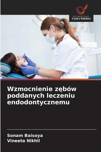 Wzmocnienie zębów poddanych leczeniu endodontycznemu