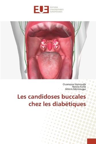 Les candidoses buccales chez les diabétiques
