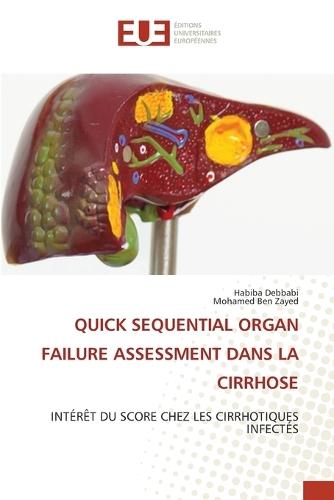 Quick Sequential Organ Failure Assessment Dans La Cirrhose