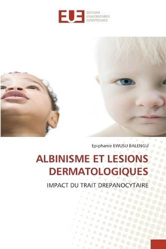 Albinisme Et Lesions Dermatologiques