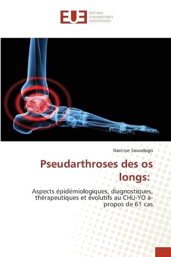 Pseudarthroses des os longs