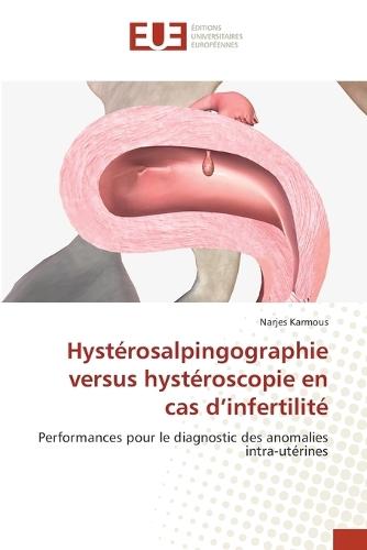 Hystérosalpingographie versus hystéroscopie en cas d'infertilité