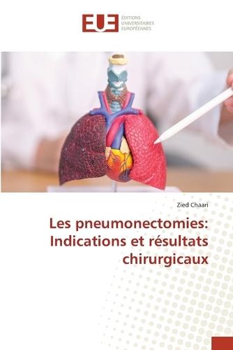 Les pneumonectomies: Indications et résultats chirurgicaux