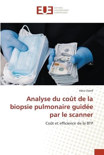 Analyse du coût de la biopsie pulmonaire guidée par le scanner