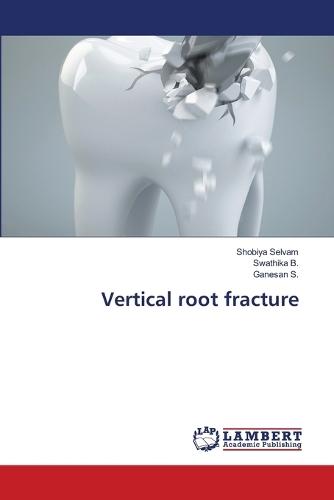 Vertical root fracture