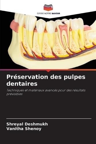 Préservation des pulpes dentaires