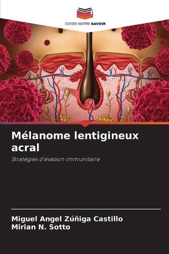 Mélanome lentigineux acral