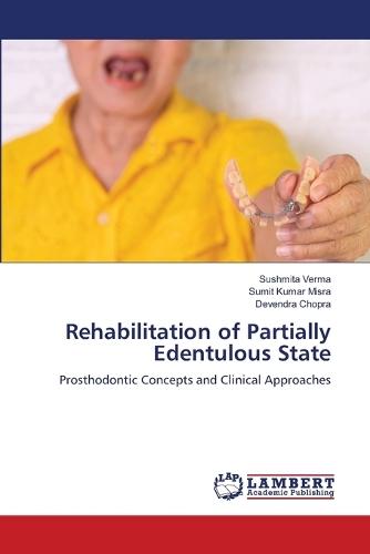 Rehabilitation of Partially Edentulous State