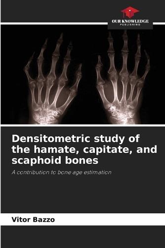 Densitometric study of the hamate, capitate, and scaphoid bones