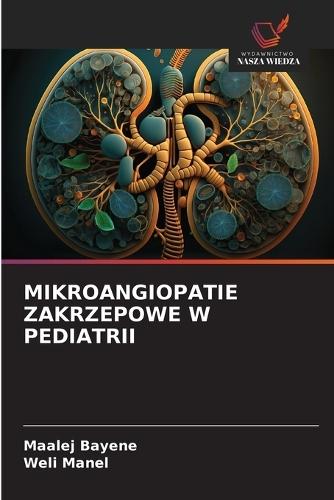 Mikroangiopatie Zakrzepowe W Pediatrii