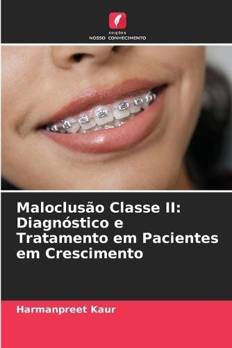Maloclusão Classe II: Diagnóstico e Tratamento em Pacientes em Crescimento