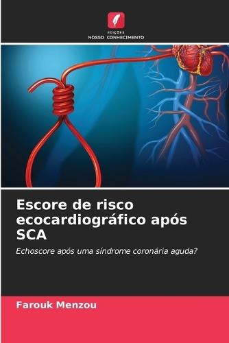 Escore de risco ecocardiográfico após SCA
