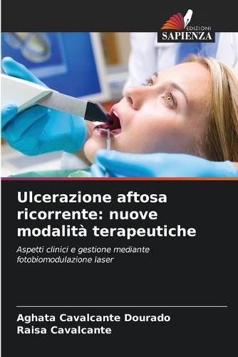 Ulcerazione aftosa ricorrente: nuove modalità terapeutiche