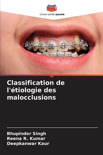 Classification de l'étiologie des malocclusions