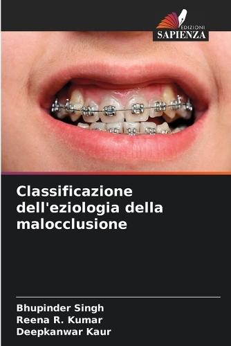 Classificazione dell'eziologia della malocclusione