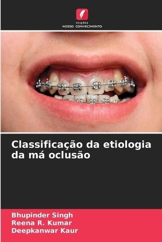 Classificação da etiologia da má oclusão