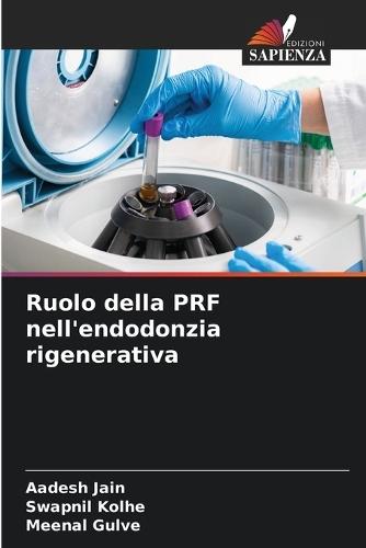 Ruolo della PRF nell'endodonzia rigenerativa