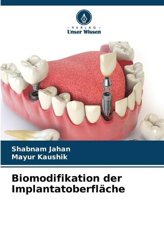 Biomodifikation der Implantatoberfläche