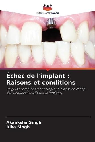 Échec de l'implant: Raisons et conditions