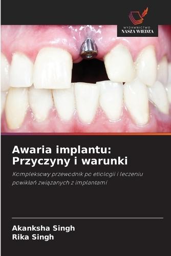 Awaria implantu: Przyczyny i warunki