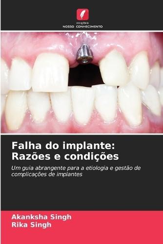Falha do implante: Razões e condições