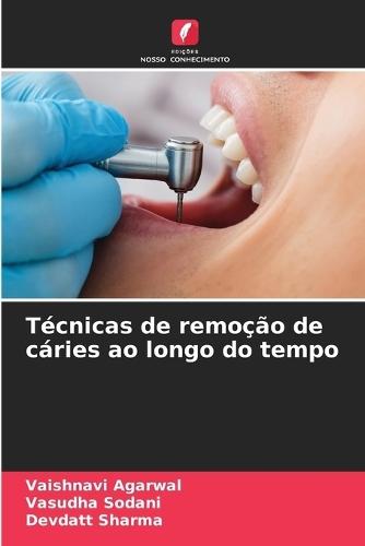 T�cnicas de remo��o de c�ries ao longo do tempo