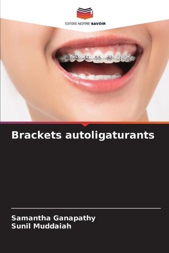 Brackets autoligaturants