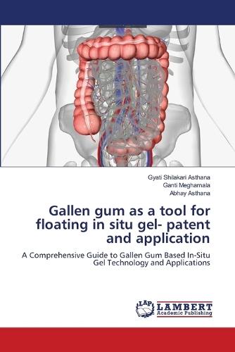 Gallen gum as a tool for floating in situ gel- patent and application