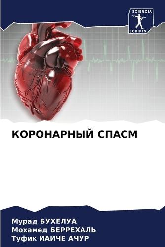 КОРОНАРНЫЙ СПАСМ