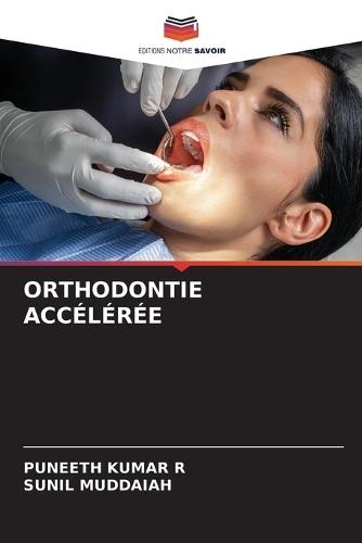 Orthodontie Acc�l�r�e