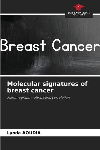 Molecular signatures of breast cancer