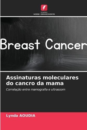 Assinaturas moleculares do cancro da mama